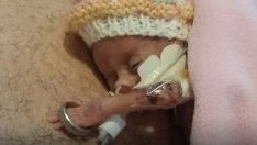 Elleri babasının alyansının içinden geçebilen prematüre bebek aylar sonra hayata tutundu! İşte onun son hali…