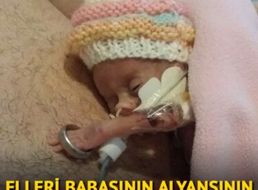 Elleri babasının alyansının içinden geçebilen prematüre bebek aylar sonra hayata tutundu! İşte onun son hali…