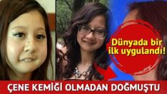 Çene kemiği olmadan doğdu ama… İşte ezber bozan çene ameliyatı