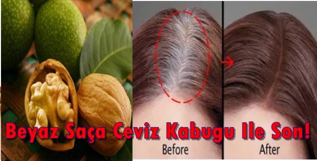 Beyaz Saça Ceviz Kabuğu İle Elvade Deyin