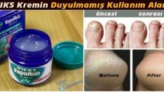 Vicks’in Bilinmeyen Faydaları Ve Kullanım Alanları