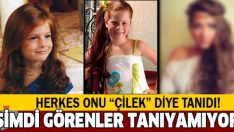 Sihirli Annem’in Çilek’i Büyüdü Son Hali Görenleri Şok Ediyor