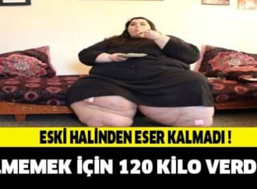 Yaşamak İçin 120 Kilo Verdi!! Şimdiki haline İNANAMAYACAKSINIZ..!