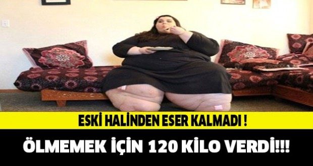 Yaşamak İçin 120 Kilo Verdi!! Şimdiki haline İNANAMAYACAKSINIZ..!