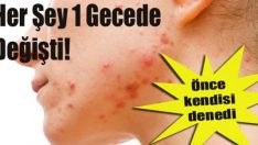 Sivilceyi 1 gecede geçiren yöntem
