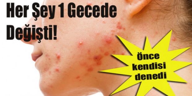 Sivilceyi 1 gecede geçiren yöntem