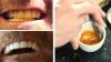 Sadece 3 Malzeme İle Sararmış Dişlere Elveda – Bembeyaz Dişlere Merhaba Deyin