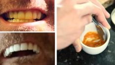 Sadece 3 Malzeme İle Sararmış Dişlere Elveda – Bembeyaz Dişlere Merhaba Deyin