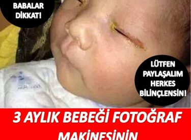 3 aylık bir bebek, fotoğraf makinesinin flaşı yüzünden kör oldu