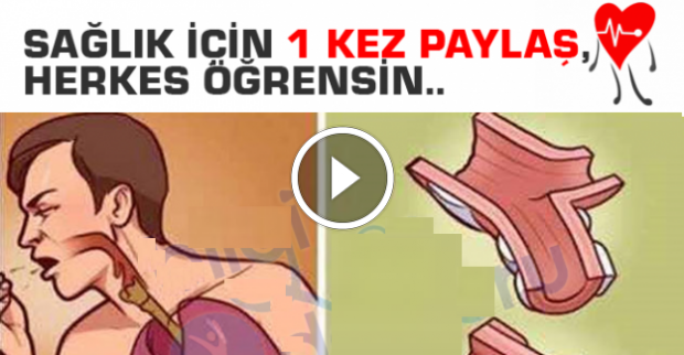 Balgamlı öksürüğü 2 saatte akciğerden komple attırıyor…