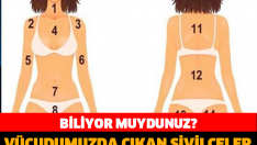 BİLİYOR MUYDUNUZ? VÜCUDUMUZDA ÇIKAN SİVİLCELER BİZE NEYİ ANLATIYOR?
