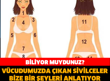 BİLİYOR MUYDUNUZ? VÜCUDUMUZDA ÇIKAN SİVİLCELER BİZE NEYİ ANLATIYOR?