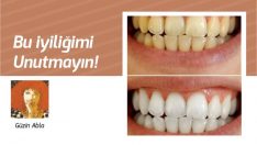 Dişlerinizi evinizde 2 dakikada beyazlatın