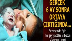 Sezaryanda öyle bir şey yaptılar ki bütün vücudunu sardı! Gerçek 6 ay sonra ortaya çıktığında…