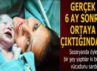 Sezaryanda öyle bir şey yaptılar ki bütün vücudunu sardı! Gerçek 6 ay sonra ortaya çıktığında…