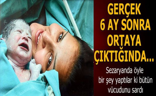 Sezaryanda öyle bir şey yaptılar ki bütün vücudunu sardı! Gerçek 6 ay sonra ortaya çıktığında…
