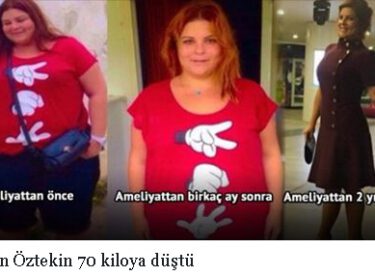 Pelin Öztekin 70 kiloya düştü