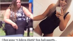 Obez anne 75 kiloya düştü! Son hali şaşırttı…