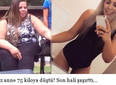 Obez anne 75 kiloya düştü! Son hali şaşırttı…