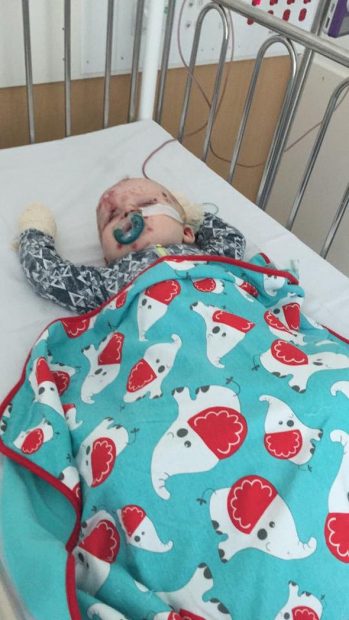 Aşısı yaptırılmayınca zavallı bebek hem kendi bu hale geldi hem de…