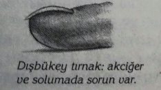 Tırnaklarınızın Sağlığınız Hakkında Bilgi Verdiğini Biliyor Muydunuz