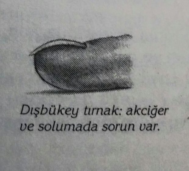 Tırnaklarınızın Sağlığınız Hakkında Bilgi Verdiğini Biliyor Muydunuz