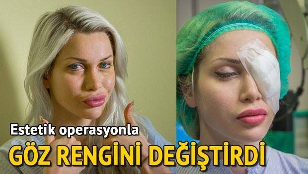 Pixee Fox şimdi de estetik operasyonla göz rengini değiştirdi