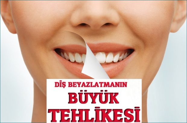 Diş beyazlatmadaki büyük tehlike!