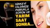 Sirkeyi cildinize pamukla sürün ve
