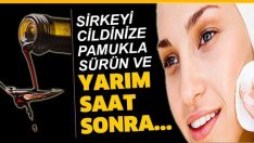 Sirkeyi cildinize pamukla sürün ve