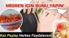 BAŞ AĞRISINI 5 DAKİKADA GEÇİREN MUCİZE ÇÖZÜM..