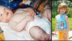 Vücudunda Sayısız Doğum Lekesiyle Doğdu – 19 Yıl Sonra Kendisiyle Dalga Geçenlerin Yüzünü Böyle Kızarttı