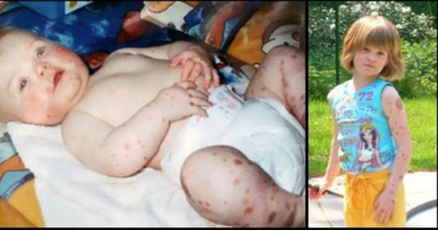 Vücudunda Sayısız Doğum Lekesiyle Doğdu – 19 Yıl Sonra Kendisiyle Dalga Geçenlerin Yüzünü Böyle Kızarttı