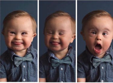 Reklam Ajansı Down Sendromlu Diye Oğlunu Reddetti Annenin Cevabını Yüz Binlerce Kişi Beğendi