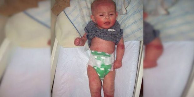 Doktorların Dediklerine Aldanmayarak Kendi Çözümünü Buldu. Anne, Bebeğinin Acı İçinde Kıvrandığını Görünce