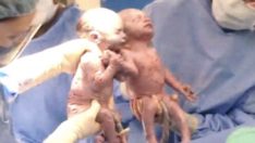 Dünyaya Yeni Gelen Bebeklerin Ellerini Gören Doktorlar Gözyaşlarına Hakim Olamadı.