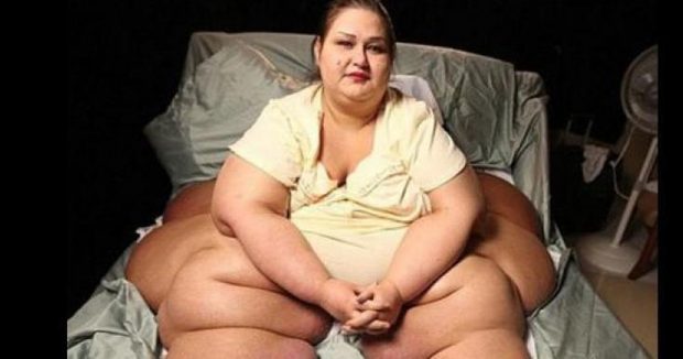 467 Kiloydu Ve Yürüyemiyordu – Şu Anda Onu Görenler Gözlerine İnanamıyor