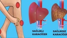 Vücudunuz Önceden Sizi Uyarıyor – İşte Karaciğerinizde Sorun Olduğunu Anlamanın Yolları