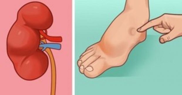 Vücudunuz Felç Geçirmeden Önce Sizi Uyarıyor – İşte Felç Geçirmek Üzere Olduğunuzun 8 İşareti