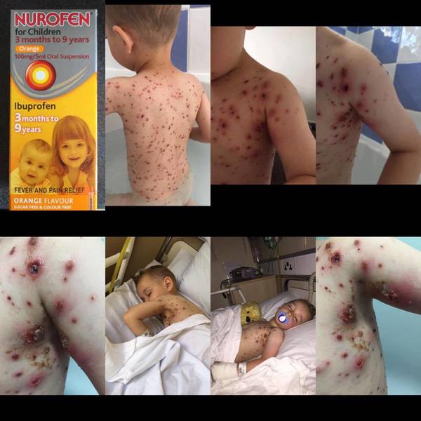 Ateşi Çıkan Çocuk Ağlamaya Başladı Derken Anne Doktorun