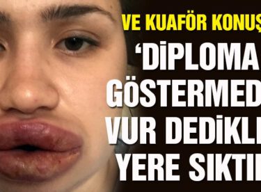 Merve Keleş’e silikon uygulaması yapan kuaför konuştu