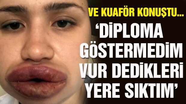 Merve Keleş’e silikon uygulaması yapan kuaför konuştu