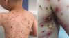 Ateşi Çıkan Çocuk Ağlamaya Başladı – Derken Anne Doktorun Hatasını Farketti