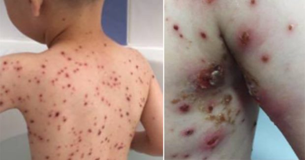 Ateşi Çıkan Çocuk Ağlamaya Başladı – Derken Anne Doktorun Hatasını Farketti