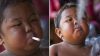 İki Yaşındayken Günde 2 Paket Sigara İçen Çocuk 6 Yılda Bakın Ne Hale Geldi