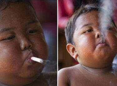 İki Yaşındayken Günde 2 Paket Sigara İçen Çocuk 6 Yılda Bakın Ne Hale Geldi