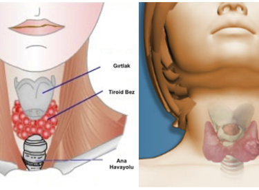 İşte Tiroid Hastası Olduğunuzun 6 Gizli İşareti – Bende Yoktur Demeyin Mutlaka Kontrol Edin