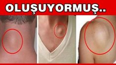 YAĞ BEZELERİ BAKIN NEDEN OLUŞUYORMUŞ.. ÖĞRENİNCE ŞOK OLACAKSINIZ