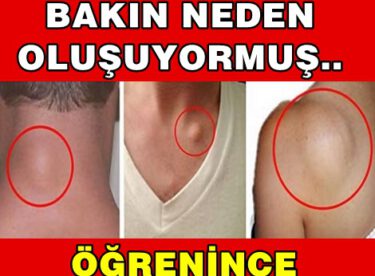 YAĞ BEZELERİ BAKIN NEDEN OLUŞUYORMUŞ.. ÖĞRENİNCE ŞOK OLACAKSINIZ