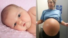 6 Kilo Doğduğu İçin Bir Anda Herkesin İlgi Odağı Olan Dünyalar Tatlısı Bebek